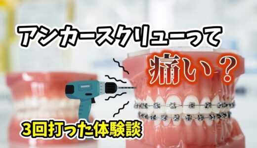 【アンカースクリューって痛い？】歯列矯正でアンカースクリュー3回打った体験談